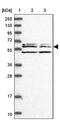 WD Repeat And Coiled Coil Containing antibody, NBP1-83612, Novus Biologicals, Western Blot image 