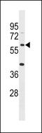 Acyl-CoA Synthetase Medium Chain Family Member 4 antibody, LS-C157536, Lifespan Biosciences, Western Blot image 