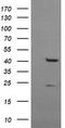 Musashi RNA Binding Protein 1 antibody, TA506364S, Origene, Western Blot image 
