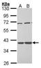 Tissue Specific Transplantation Antigen P35B antibody, GTX101663, GeneTex, Western Blot image 