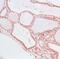 Thyroid Hormone Receptor Alpha antibody, PA5-32615, Invitrogen Antibodies, Immunohistochemistry frozen image 