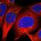 PiggyBac Transposable Element Derived 2 antibody, NBP1-85936, Novus Biologicals, Immunocytochemistry image 