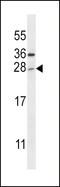 Toll Like Receptor Adaptor Molecule 2 antibody, LS-C161872, Lifespan Biosciences, Western Blot image 