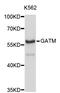 Glycine amidinotransferase, mitochondrial antibody, STJ111200, St John