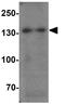 Sterol Regulatory Element Binding Transcription Factor 1 antibody, GTX31579, GeneTex, Western Blot image 