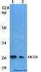 Activation Induced Cytidine Deaminase antibody, LS-C411735, Lifespan Biosciences, Western Blot image 