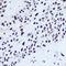 Small RNA Binding Exonuclease Protection Factor La antibody, GTX32896, GeneTex, Immunocytochemistry image 