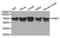 Fragile X Mental Retardation 1 antibody, STJ23680, St John