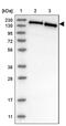 SWI/SNF Related, Matrix Associated, Actin Dependent Regulator Of Chromatin Subfamily C Member 2 antibody, PA5-54351, Invitrogen Antibodies, Western Blot image 