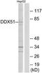 DEAD-Box Helicase 51 antibody, TA316338, Origene, Western Blot image 