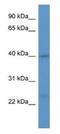 Guided Entry Of Tail-Anchored Proteins Factor 3, ATPase antibody, NBP1-79796, Novus Biologicals, Western Blot image 