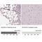 Acetyl-CoA Carboxylase Beta antibody, NBP1-90274, Novus Biologicals, Immunohistochemistry paraffin image 