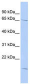 RAN Binding Protein 3 antibody, TA344302, Origene, Western Blot image 