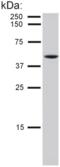 Keratin 8 antibody, LS-C45738, Lifespan Biosciences, Western Blot image 