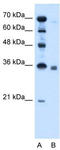 Sphingosine-1-Phosphate Phosphatase 2 antibody, TA337880, Origene, Western Blot image 