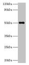 Trimethyllysine Hydroxylase, Epsilon antibody, CSB-PA023908LA01HU, Cusabio, Western Blot image 