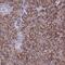 Aldehyde Dehydrogenase 1 Family Member L2 antibody, NBP1-81935, Novus Biologicals, Immunohistochemistry paraffin image 