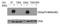 Casein Kinase 2 Alpha 1 antibody, AP26072PU-N, Origene, Western Blot image 