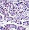 Protein Phosphatase 2 Catalytic Subunit Beta antibody, LS-C162086, Lifespan Biosciences, Immunohistochemistry paraffin image 