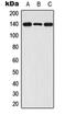 Fibroblast Growth Factor Receptor 1 antibody, orb213927, Biorbyt, Western Blot image 