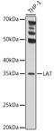Linker For Activation Of T Cells antibody, GTX32700, GeneTex, Western Blot image 
