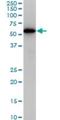 Cyclin Dependent Kinase 8 antibody, H00001024-M02, Novus Biologicals, Western Blot image 