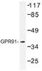 Succinate Receptor 1 antibody, AP01338PU-N, Origene, Western Blot image 