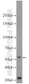 Zinc Finger And BTB Domain Containing 8A antibody, 24544-1-AP, Proteintech Group, Western Blot image 