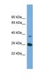 Anti-Silencing Function 1A Histone Chaperone antibody, orb330964, Biorbyt, Western Blot image 