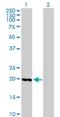 Intraflagellar Transport 27 antibody, H00011020-B01P, Novus Biologicals, Western Blot image 