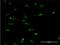 Argininosuccinate Synthase 1 antibody, H00000445-M02, Novus Biologicals, Immunocytochemistry image 