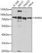 Poly(A)-Specific Ribonuclease antibody, GTX33386, GeneTex, Western Blot image 