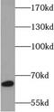 Carboxylesterase 3 antibody, FNab01617, FineTest, Western Blot image 