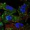 Tensin 3 antibody, PA5-63112, Invitrogen Antibodies, Immunofluorescence image 