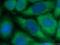 Lymphocyte Cytosolic Protein 2 antibody, 66465-1-Ig, Proteintech Group, Immunofluorescence image 