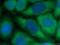 Lymphocyte cytosolic protein 2 antibody, 66465-1-Ig, Proteintech Group, Immunofluorescence image 