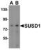 Sushi Domain Containing 1 antibody, NBP2-61129, Novus Biologicals, Western Blot image 