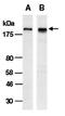SWI/SNF Related, Matrix Associated, Actin Dependent Regulator Of Chromatin, Subfamily A, Member 2 antibody, orb66840, Biorbyt, Western Blot image 