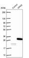 Nucleophosmin/Nucleoplasmin 3 antibody, NBP1-90999, Novus Biologicals, Western Blot image 