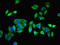 Prefoldin Subunit 5 antibody, LS-B10652, Lifespan Biosciences, Immunofluorescence image 