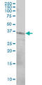 CD79b Molecule antibody, LS-C196867, Lifespan Biosciences, Western Blot image 