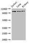 SWI/SNF Related, Matrix Associated, Actin Dependent Regulator Of Chromatin, Subfamily A Like 1 antibody, LS-C679554, Lifespan Biosciences, Western Blot image 