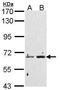 Peptidyl Arginine Deiminase 4 antibody, PA5-22317, Invitrogen Antibodies, Western Blot image 