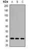 Aldo-Keto Reductase Family 1 Member B10 antibody, abx142019, Abbexa, Western Blot image 