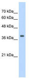 Tropomyosin alpha-1 chain antibody, TA346033, Origene, Western Blot image 