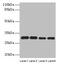 Phosphomannomutase 1 antibody, CSB-PA018237LA01HU, Cusabio, Western Blot image 