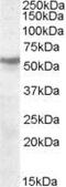 Cholinergic Receptor Nicotinic Beta 1 Subunit antibody, PA5-18924, Invitrogen Antibodies, Western Blot image 