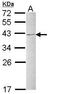 Heterogeneous nuclear ribonucleoprotein C antibody, TA308719, Origene, Western Blot image 