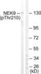 NIMA Related Kinase 9 antibody, LS-C199306, Lifespan Biosciences, Western Blot image 