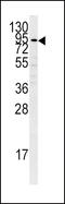 Plasminogen antibody, 62-815, ProSci, Western Blot image 